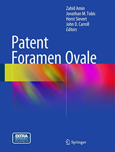 

exclusive-publishers/springer/patent-foramen-ovale--9781447149866