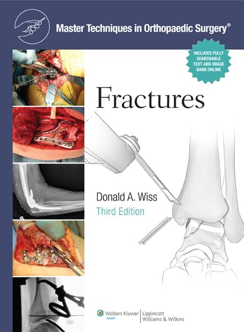 

surgical-sciences/orthopedics/master-techniques-in-orthopaedic-surgery-fractures-3ed--9781451108149