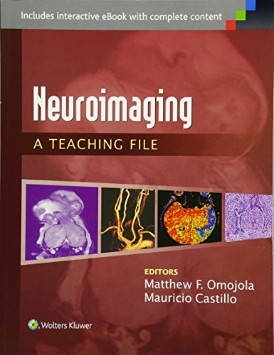 

surgical-sciences/nephrology/neuroimaging-a-teaching-file--9781451173284