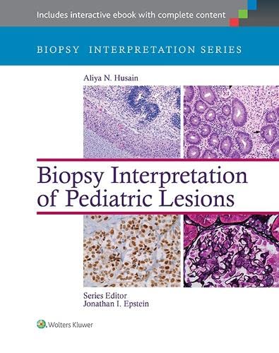

mbbs/3-year/biopsy-interpretation-of-pediatric-lesions--9781451175332