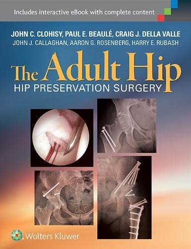 

mbbs/4-year/the-adult-hip-hip-preservation-surgery-9781451183931