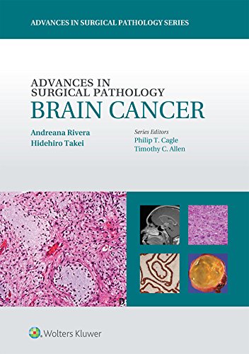 

exclusive-publishers/lww/advances-in-surgical-pathology-brain-cancer-9781451190915