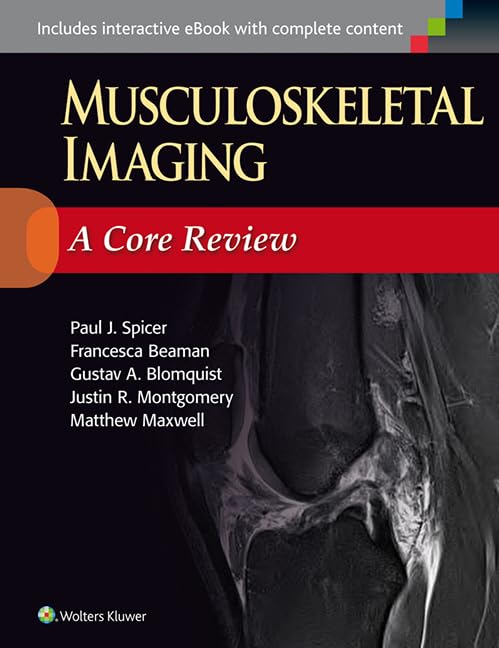 

exclusive-publishers/lww/musculoskeletal-imaging-a-core-review--9781451192674