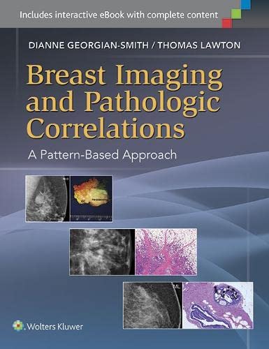 

clinical-sciences/radiology/breast-imaging-and-pathologic-correlations-a-pattern-based-approach-9781451192698