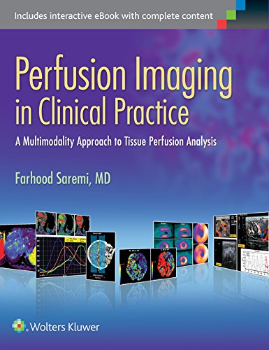 

mbbs/4-year/perfusion-imaging-in-clinical-practice-a-multimodality-approach-to-tissue-perfusion-analysis-9781451193169