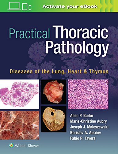 exclusive-publishers/lww/practical-thoracic-pathology-diseases-of-the-lung-heart-and-thymus-1-ed--9781451193510