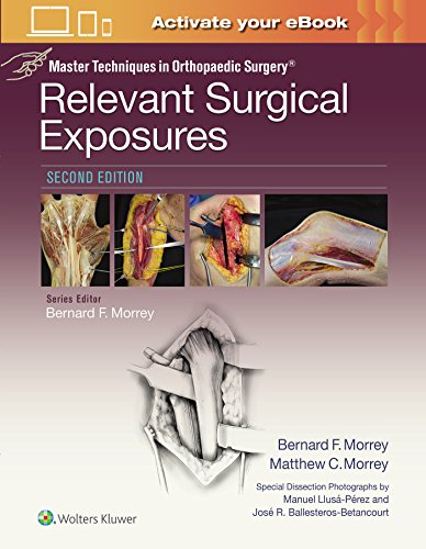 

surgical-sciences/orthopedics/master-techniques-in-orthopaedic-surgery-relevant-surgical-exposures-2ed-9781451194067