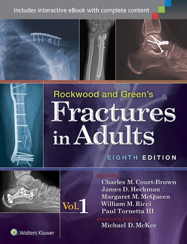 

general-books/general/rockwood-and-green-s-fractures-in-adults-international-edition-in-two-volumes--9781451195088