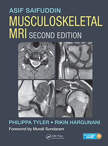 

mbbs/4-year/musculoskeletal-mri-2-ed-9781482247800