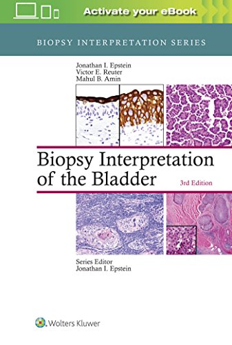 

exclusive-publishers/lww/biopsy-interpretation-of-the-bladder-3ed--9781496315045