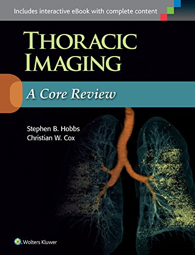 

exclusive-publishers/lww/thoracic-imaging-a-core-review-revised-reprint--9781496347480