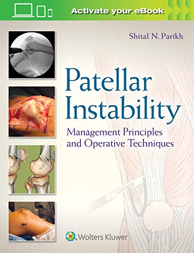 

exclusive-publishers/lww/patellar-instability-management-principles-and-operative-techniques--9781496380821