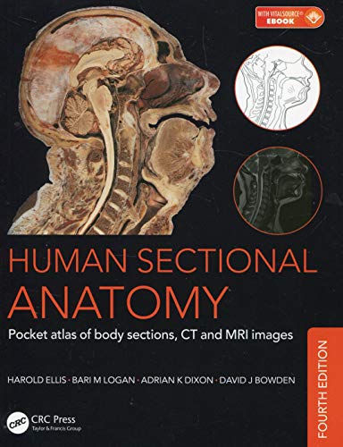 mbbs/1-year/human-sectional-anatomy-pocket-atlas-of-body-sections-ct-and-mri-images-4-ed--9781498708548