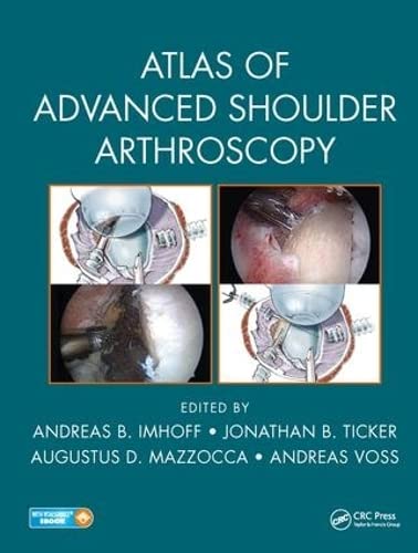

general-books/general/atals-of-advanced-shoulder-arthroscopy-9781498787482
