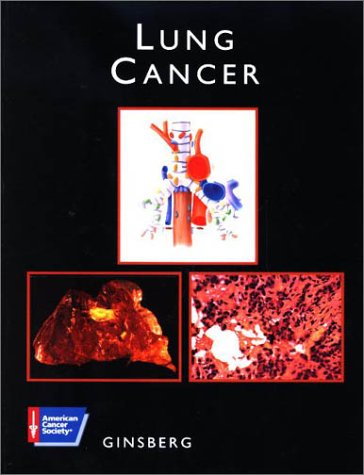 

surgical-sciences/oncology/lung-cancer-9781550090994