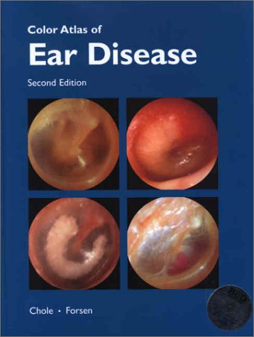 

special-offer/special-offer/color-atlas-of-ear-diseases-2-ed-9781550091670