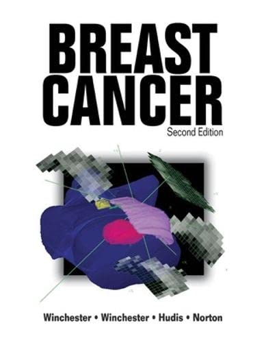 

general-books/general/breast-cancer-2-ed--9781550092721