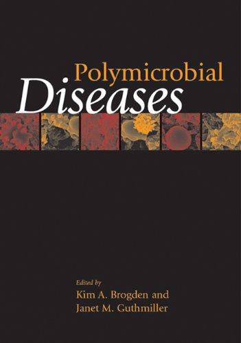

basic-sciences/microbiology/polymicrobial-diseases-9781555812447