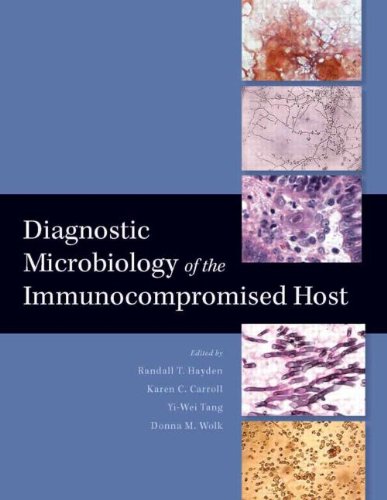 

basic-sciences/microbiology/diagnostic-microbiology-of-the-immunocompromised-host-9781555813970