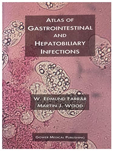 

general-books/general/atlas-of-gastrointestinal-and-hepatobiliary-infections--9781563755552