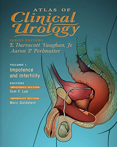

surgical-sciences/urology/atlas-of-clinical-urology-impotence-and-infertility-1-atlas-of-clinical-9781573401197