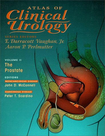 

general-books/general/clinical-urology-volume-ii-the-prostate-atlas-of-clinical-urology--9781573401234