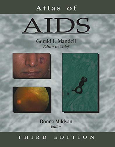 

mbbs/2-year/atlas-of-aids-atlas-of-infectious-diseases-3-ed-9781573401562