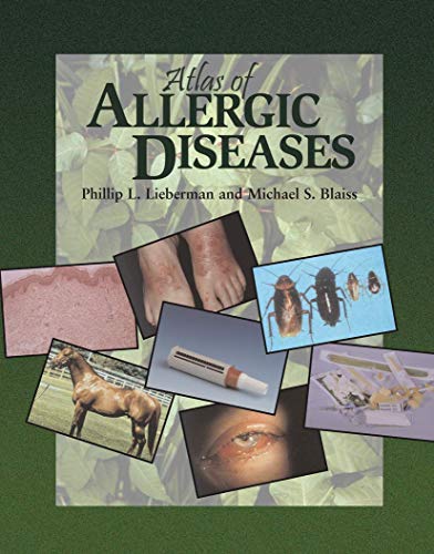 

mbbs/2-year/atlas-of-allergic-diseases-9781573401821