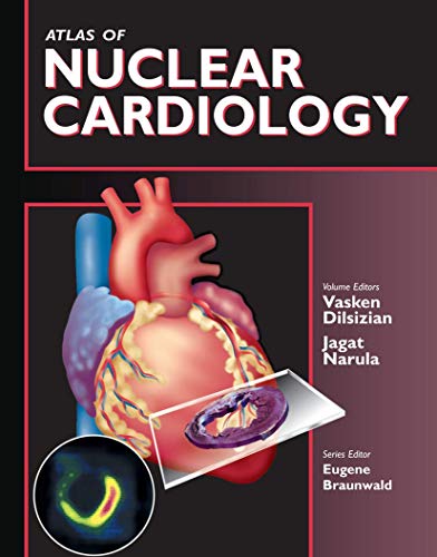 

clinical-sciences/cardiology/atlas-of-nuclear-cardiology-9781573401852