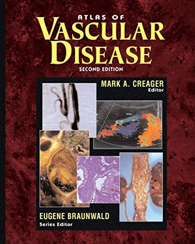 

clinical-sciences/cardiology/atlas-of-vascular-disease-9781573401913