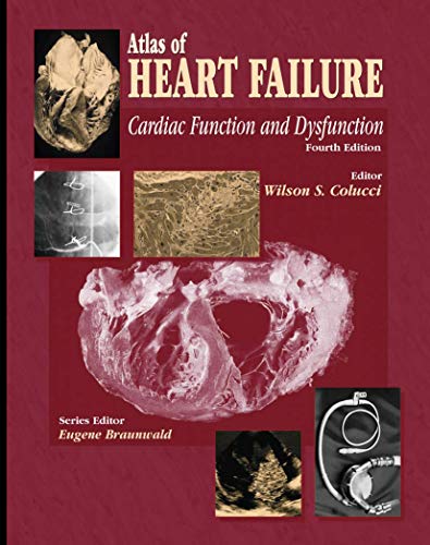 

clinical-sciences/cardiology/atlas-of-heart-failure-cardiac-function-and-dysfunction-4th-edition-9781573402132