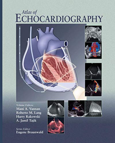 

special-offer/special-offer/atlas-of-echocardiography--9781573402170