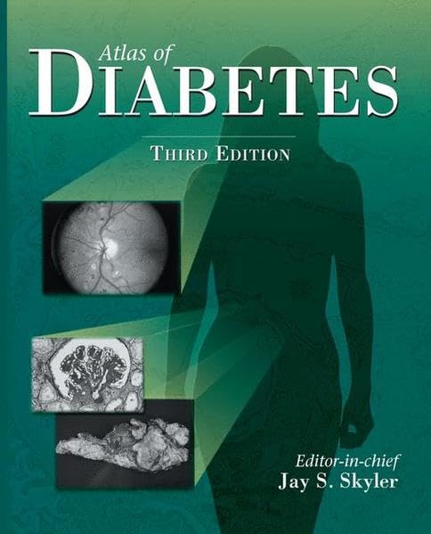 

general-books/general/atlas-of-diabetes-3ed--9781573402224