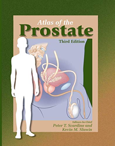 

special-offer/special-offer/atlas-of-the-prostate-3-ed--9781573402293