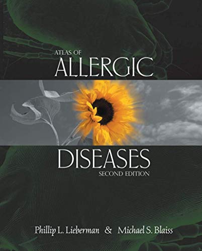 

special-offer/special-offer/atlas-of-allergic-diseases-2ed--9781573402347