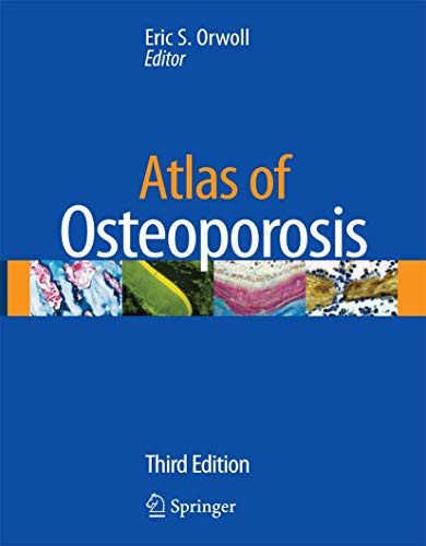 

mbbs/4-year/atlas-of-osteoporosis-cd-included-3-ed-9781573402965