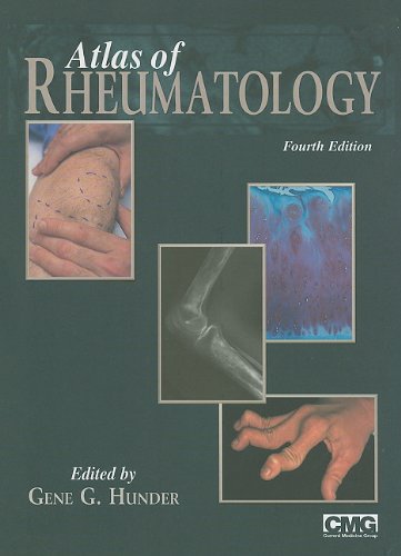 

surgical-sciences/orthopedics/atlas-of-rheumatology-4-ed-9781573403573