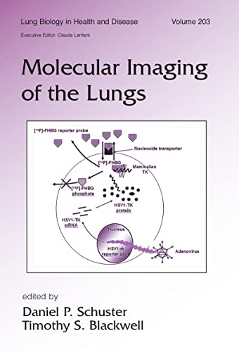 

special-offer/special-offer/molecular-imaging-of-the-lungs-lung-biology-in-health-and-disease--9781574448542