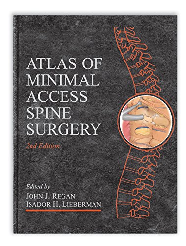 

general-books/general/atlas-of-minimal-access-spine-surgery-2-ed--9781576261002