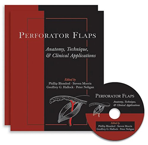 

general-books/general/perforator-flaps-anatomy-technique-clinical-applications-2e-2-vols-set-with-dvd-rom--9781576263174