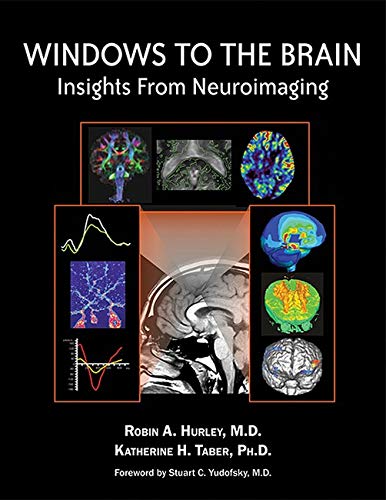 

special-offer/special-offer/windows-to-the-brain-insights-from-neuroimaging--9781585623020
