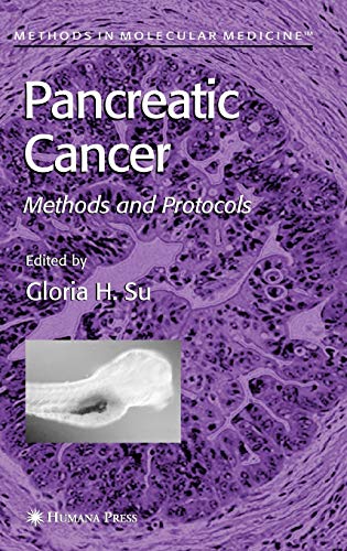 

mbbs/4-year/pancreatic-cancer--9781588291073
