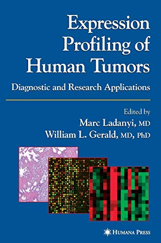 

surgical-sciences/oncology/expression-profiling-of-human-tumors-9781588291226