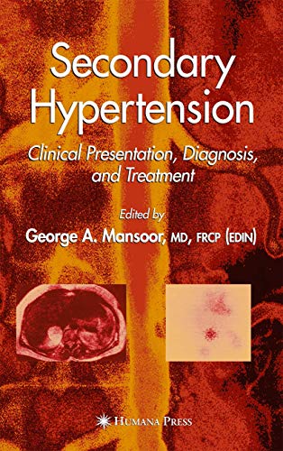 

special-offer/special-offer/secondary-hypertension-clinical-presentation-diagnosis-and-treatment--9781588291417