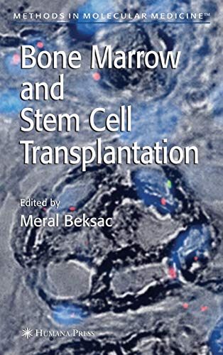 

special-offer/special-offer/bone-marrow-and-stem-cell-transplantation-hb--9781588295958