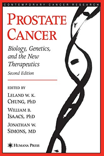 

exclusive-publishers/springer/prostate-cancer-biology-genetics-and-the-new-therapeutics-2ed--9781588296962
