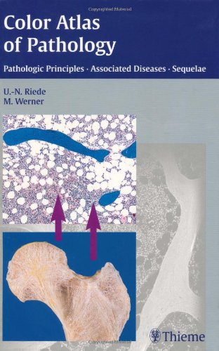 

exclusive-publishers/thieme-medical-publishers/color-atlas-of-pathology-pathologic-principles-associated-diseases-sequelae--9781588901170