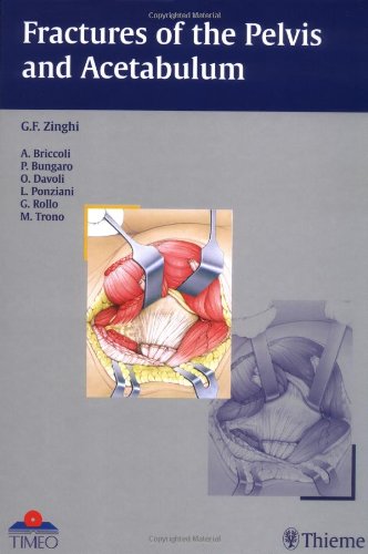 

general-books/general/fractures-of-the-pelvis-and-acetabulum-1-ed--9781588901644