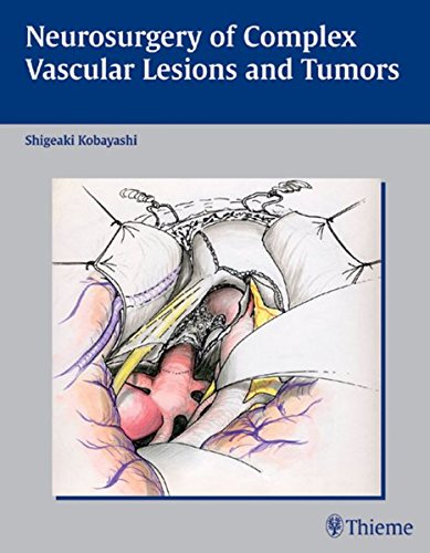 

exclusive-publishers/thieme-medical-publishers/neurosurgery-of-complex-vascular-lesions-and-tumors-1-e--9781588902245