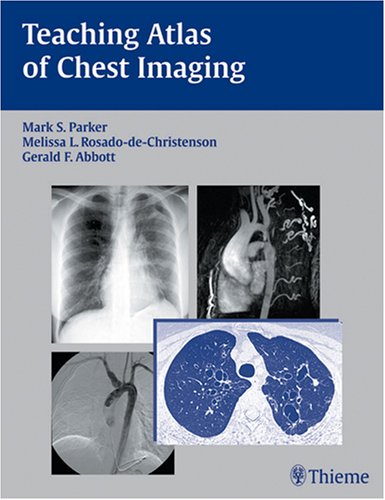 

exclusive-publishers/thieme-medical-publishers/teaching-atlas-of-chest-imaging-9781588902306
